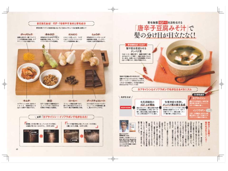 円形脱毛症　病院""